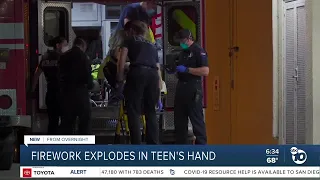 Teen hospitalized after firework explodes in his hand