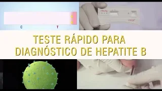 Teste rápido para o diagnóstico da Hepatite B VIKIA HBsAg