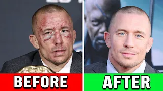 MMA Fighters That Needed Facial Surgery AFTER A Fight!