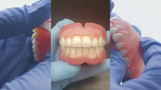 Part of the Process - Setting 3D Printed Denture Teeth