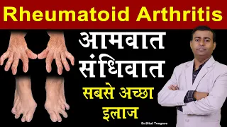 rheumatoid arthritis आमवात, संधिवात सबसे अच्छा इलाज I rheumatoid arthritis in hindi