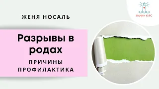 Разрывы в родах. Эфир с Марией Трегубовой