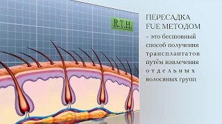 2. Метод пересадки волос FUE в RTH