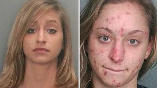 10 Shocking Before And After Drug Use Photos