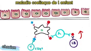 maladie coeliaque de l enfant