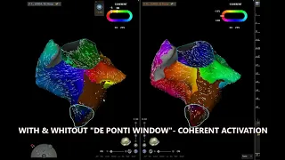 REDO OF RIGHT ATRIAL FLUTTER ABLATION - DECANAV & V7 PRIME WORKFLOW