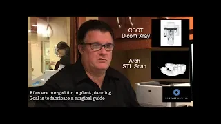 DTX Studio™ Implant  - Scott MacLean -  Live Treatment Planning for a Lower Molar