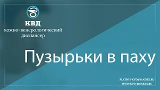 183  Пузырьки в паху