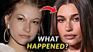 Hailey Bieber's Face - Before and After