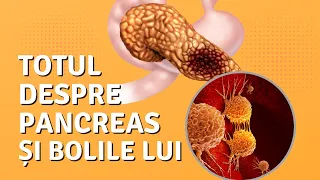 Totul despre pancreas si bolile acestuia | CANCERUL DE PANCREAS | dr. Octav Ginghină