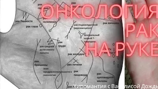 Онкология, рак на руке. Болезни на ладони. Не пугайтесь! Хиромантия