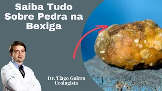 Saiba Tudo Sobre Pedra na Bexiga