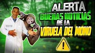 🟢Buenas noticias sobre la viruela del Mono🟢