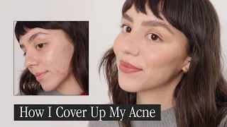 How I Cover Up My Acne Scars | Oily Skin + Acne Prone