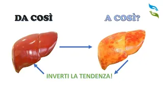 FEGATO GRASSO. Ecco segni, sintomi e cosa fare.