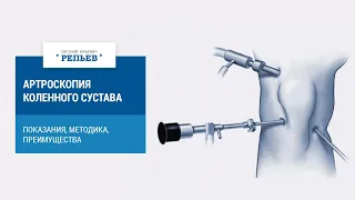 Артроскопия коленного сустава: показания, методика, преимущества