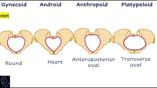 Female pelvic types