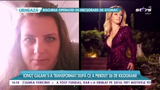 Vedete care și-au tăiat stomacul pentru a slăbi