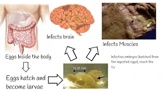 Neurocisticcircosis  symptoms and treatment.   Why is pork tapeworm so dangerous?