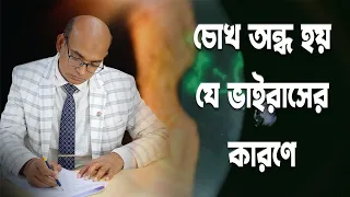 চোখ অন্ধ হয় যে ভাইরাসের কারণে | VIRAL KERATITIS || Dr. Md. Masudul Hasan | Cornea Specialist ||