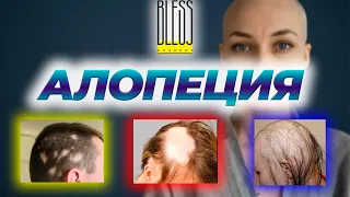 АЛОПЕЦИЯ. Виды и симптомы. Причины выпадения волос. Домашний ТЕСТ на выпадение ВОЛОС.