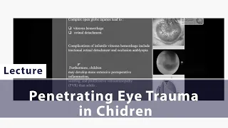 Penetrating Eye Trauma in Chidren