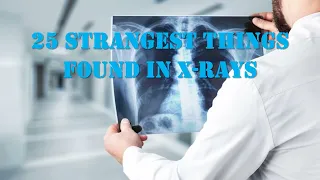 25 STRANGEST THINGS FOUND IN X-RAYS!