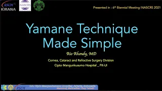Yamane  Technique Made Simple