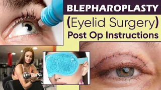 ✅ Post op Blepharoplasty Care in Hindi |✅Blepharoplasty (Eyelid Surgery) Post Operative Instructions