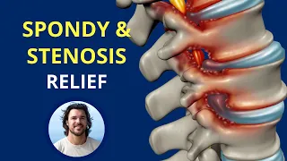 RELIEF from Spondylolisthesis and Stenosis