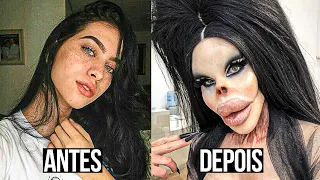 AS CIRURGIAS PLÁSTICAS DE FAMOSOS QUE DERAM MUITO ERRADO!!! Parte 2