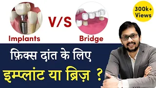 Dental Implants vs. Tooth Bridge क्या है बेहतर? Seraphic Dental Indore