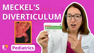 Meckel's Diverticulum: Alterations in Health - Gastrointestinal Pediatrics | @LevelUpRN