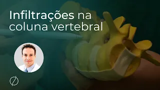 Infiltrações na Coluna Vertebral - Médico Especialista em Coluna.