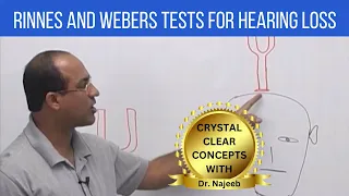 Rinnes and Webers Tests for Hearing Loss | ENT