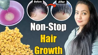 1 महीने में *Onion Juice* से बालों को GROW करने का BEST तरीका जो कोई नहीं बताएगा | 100% Result❤️