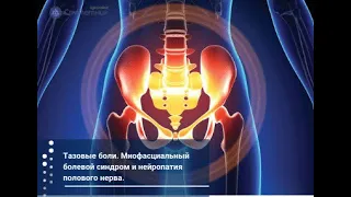 Тазовые боли. Миофасциальный болевой синдром и нейропатия полового нерва.