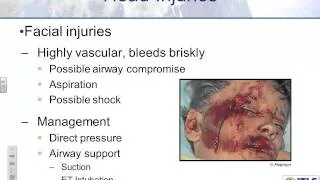 ITLS Chapter 10 Head Trauma