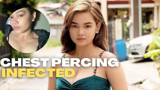 Xyriel Manabat, the chest and neck piercing got infected