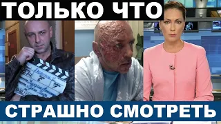 "Никто не может помочь..." Погибает любимый миллионами актёр