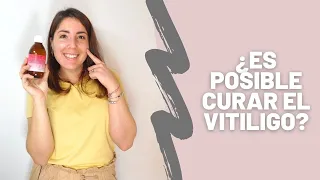 ¿ES POSIBLE ELIMINAR EL VITILIGO? TE CUENTO MI HISTORIA