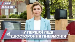 Підсумковий випуск новин за 18:00: Стан Олени Зеленської