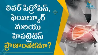 లివర్ సిర్రోసిస్, ఫెయిల్యూర్ మరియు హెపటైటిస్ లివర్ మార్పిడికి దారితీస్తాయా?