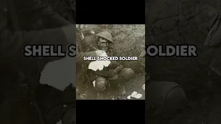 DISTURBING IMAGES Of WW1!😱 #ww1 #warshorts #disturbing