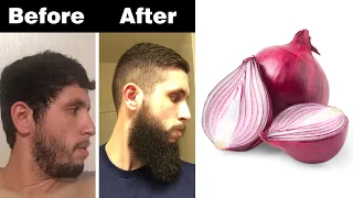 How to Grow Beard Faster Naturally at Home for Teenager | Beard Growth Home Remedy