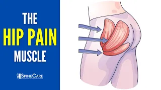 The Hip Pain Muscle (How to Release It for INSTANT RELIEF)