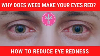 Why Does Marijuana Cause Red Eyes