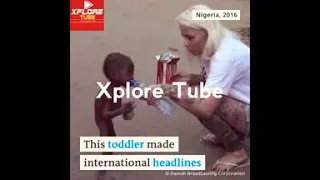 SO TOUCHING!!! Nigerian Allege Witch Child Rescued And Transformed By Foreign Aid.