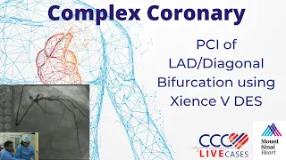 PCI of LAD/Diagonal Bifurcation using Xience V DES - December 15, 2009 Webcast Video