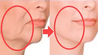 Anti-Aging Face Lifting Massage For Sagging Jowls, Cheeks! Look 20 Years Younger, Tighten The Skin